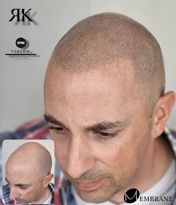 Ryan Kingsbury Scalp Micro Pigmentation place picture
